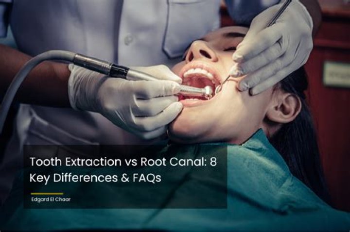 Is it better to get a root canal or pull the tooth?