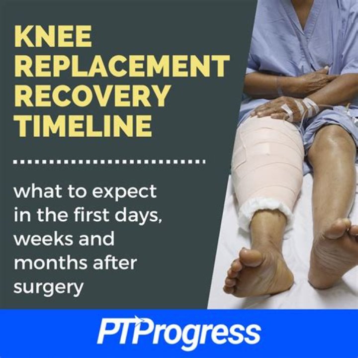 Is it normal to sleep a lot after knee replacement surgery?