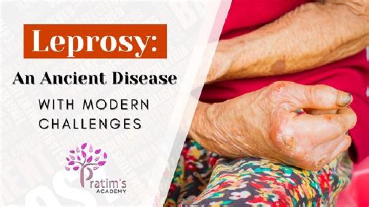 Is leprosy curable nowadays?