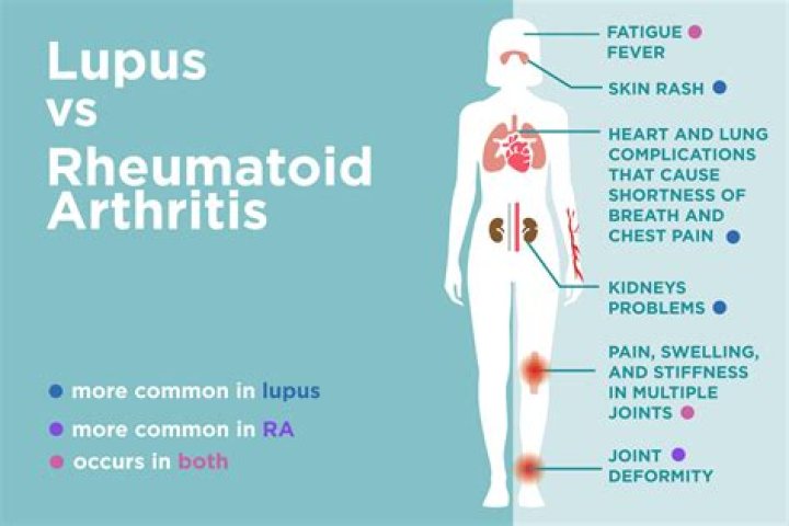 Is lupus or rheumatoid arthritis worse?