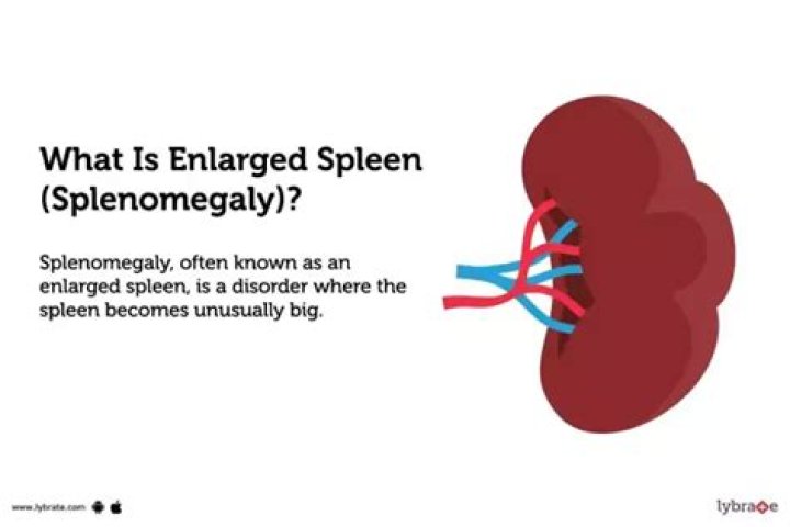 Is splenomegaly curable?