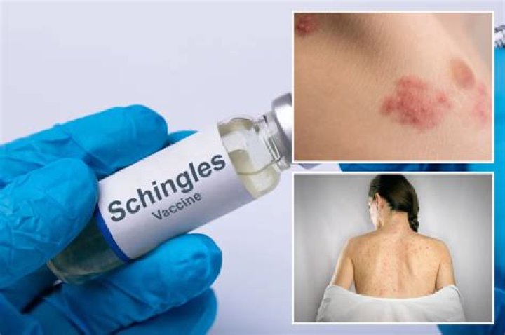 Is there a downside to the shingles vaccine?
