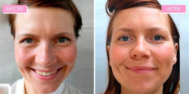 Is water good for your skin?