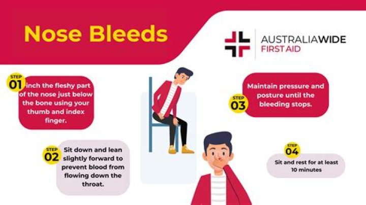 Should I hold my head back when I have a nosebleed?