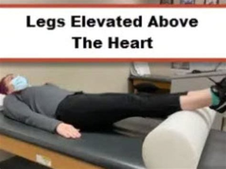 Should I keep my broken leg elevated?