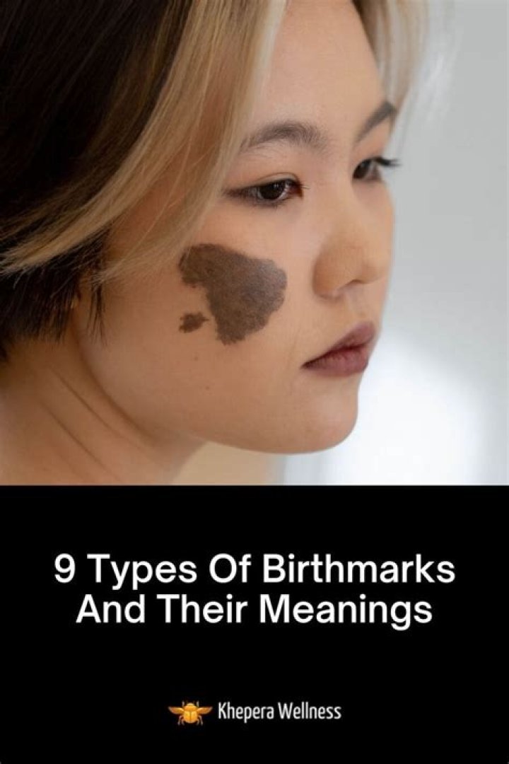 What's the meaning of birthmarks?