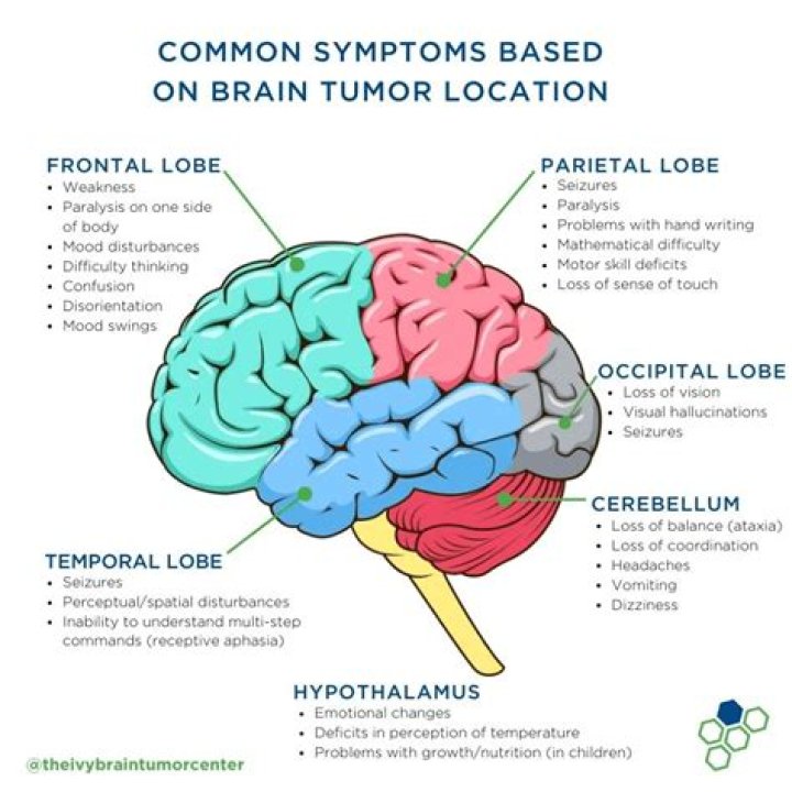 What are brain tumors headaches like?