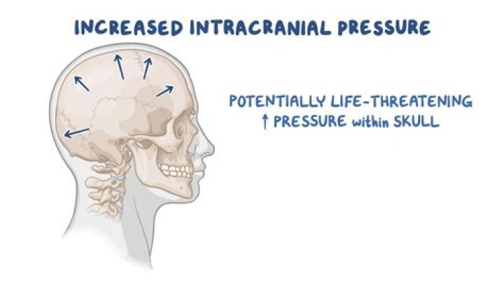 What are early signs of increased intracranial pressure?
