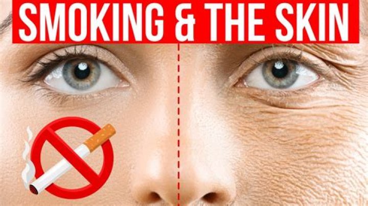 What are Skins for smoking?