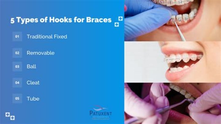 What are the 5 types of hooks?
