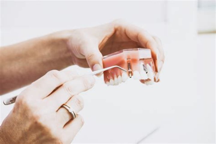 What are the hardest teeth to extract?