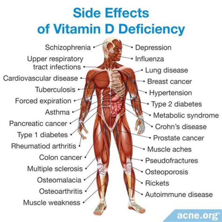 What are the side effects of taking vitamin D3?