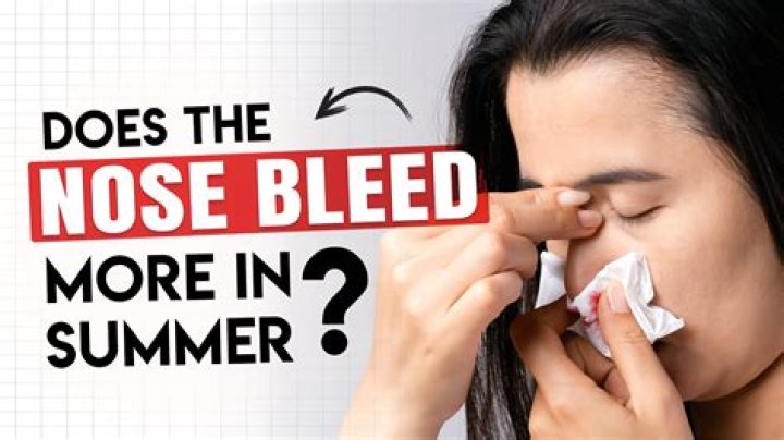 What are the three groups of nosebleeds and which is most common?