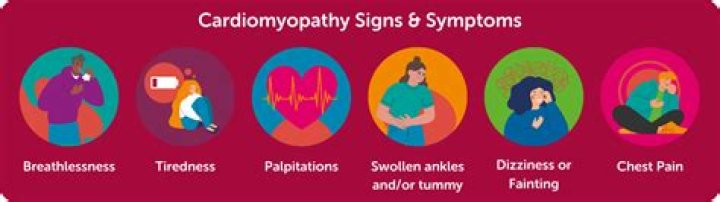 What are the warning signs of cardiomyopathy?