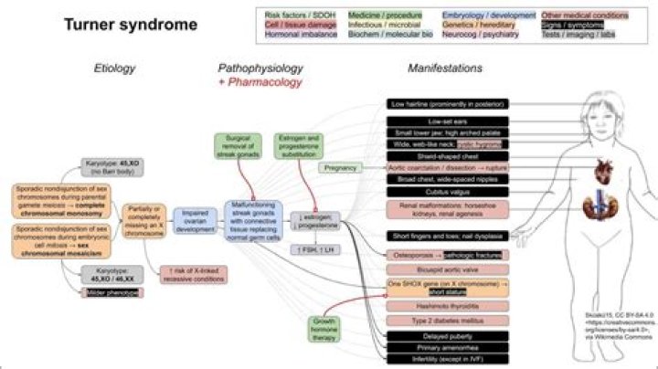 What are three symptoms of Turner's syndrome?