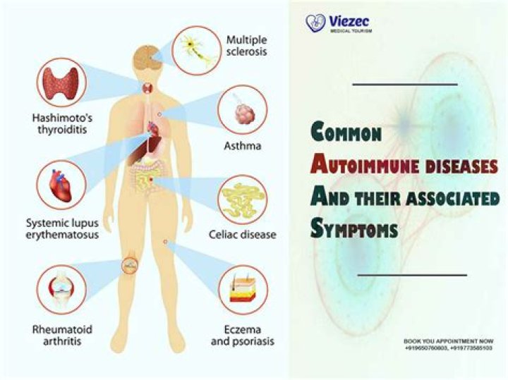 What autoimmune disease is associated with eczema?