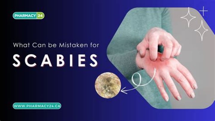 What can be mistaken for a mole?