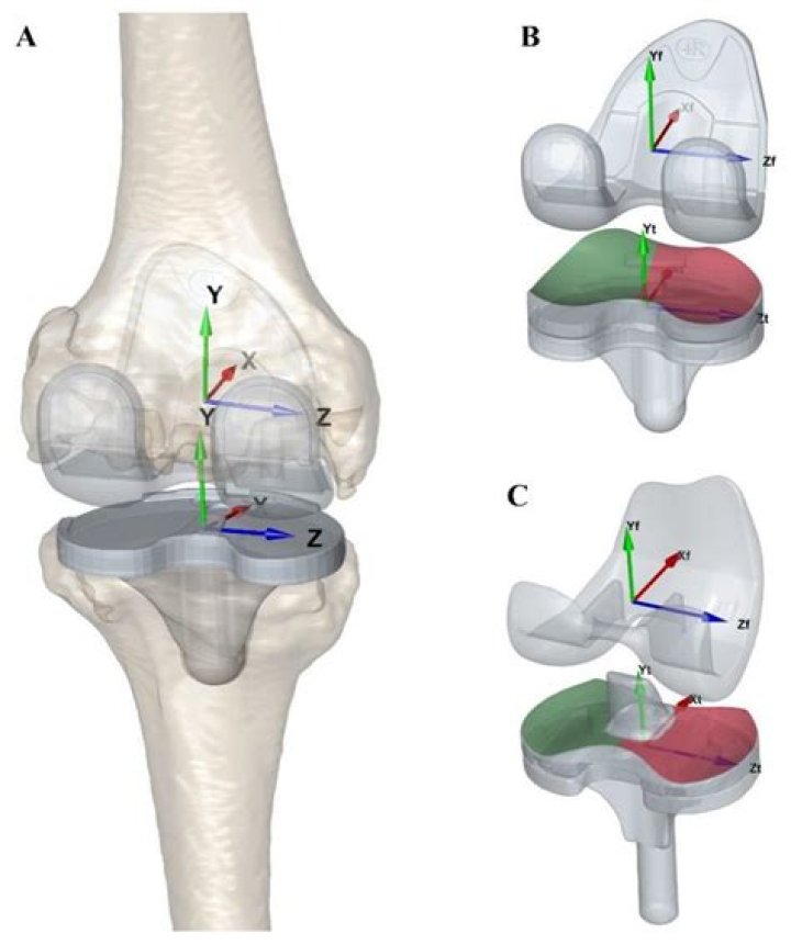What can you do instead of having a knee replacement?