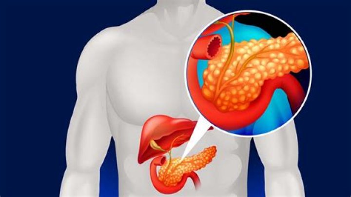 What causes an inflamed pancreas?