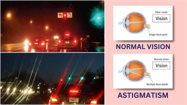 What causes astigmatism?