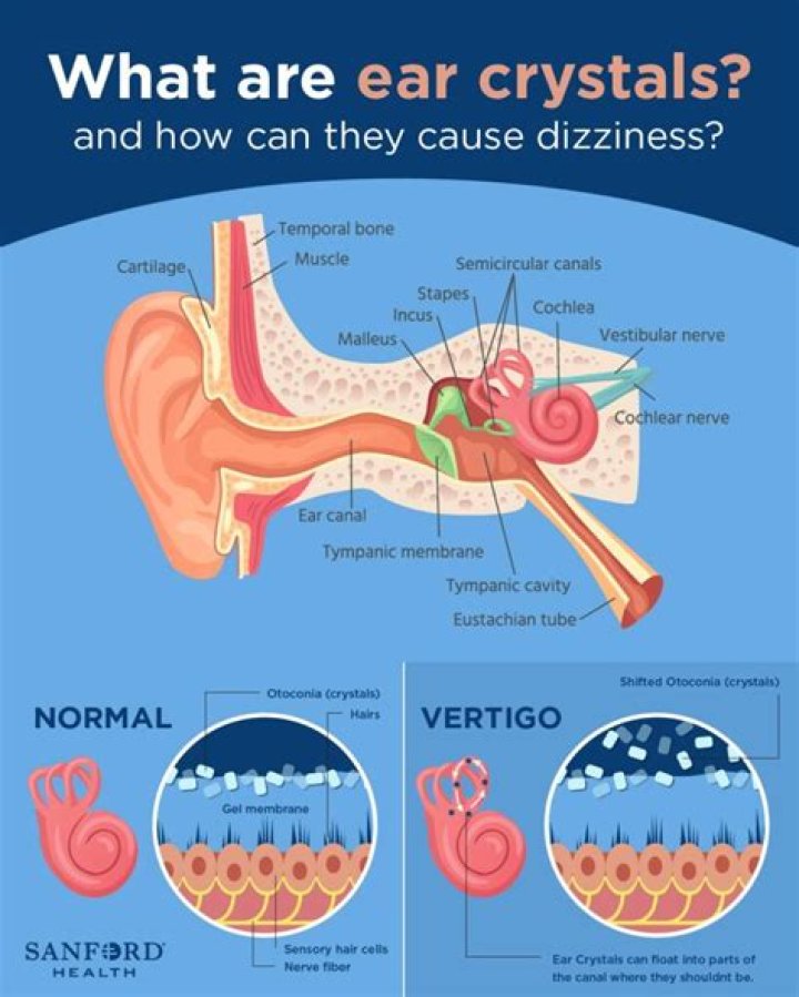 What causes crystals on the brain?