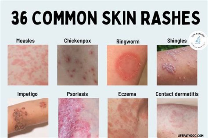 What causes skin rashes?