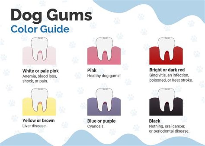 What color are black people's gums?