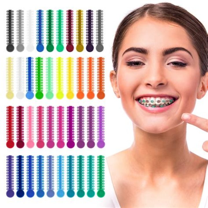 What color braces go best with yellow teeth?