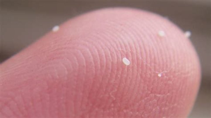 What Colour is flea eggs?