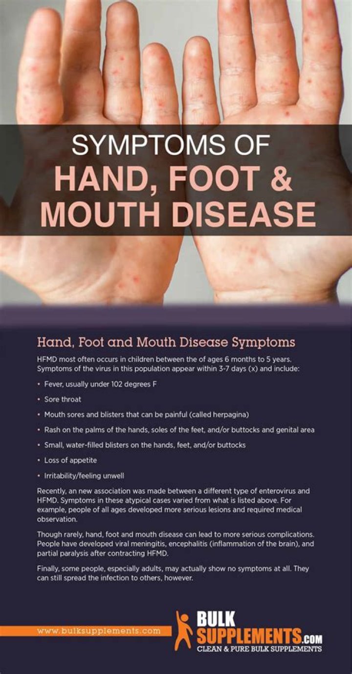 What do hand foot and mouth look like?