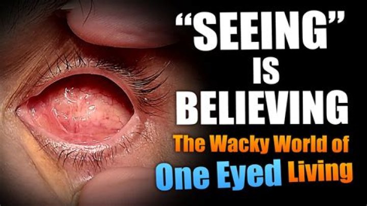 What do you call a person with one eye?