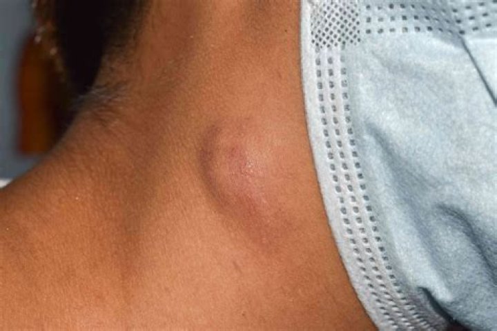 What doctor should I see for numbness and tingling?
