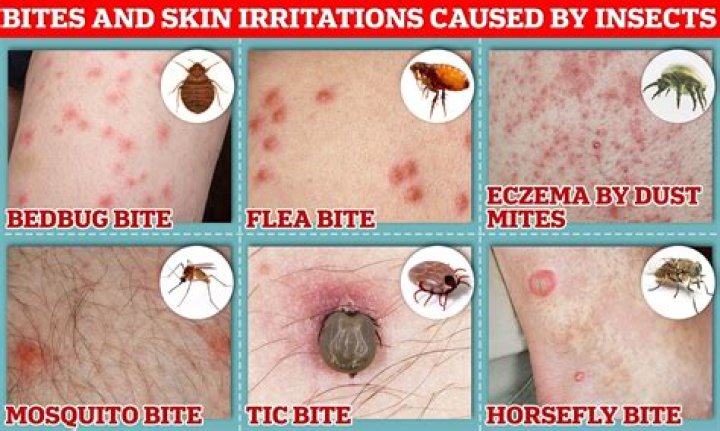 What does a bed bug bite look like on a human?