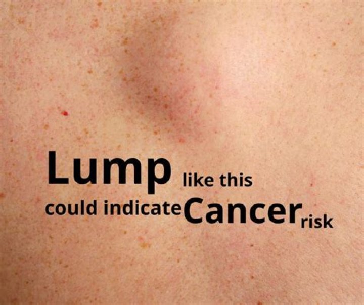 What does a cancerous lump look like on the scalp?