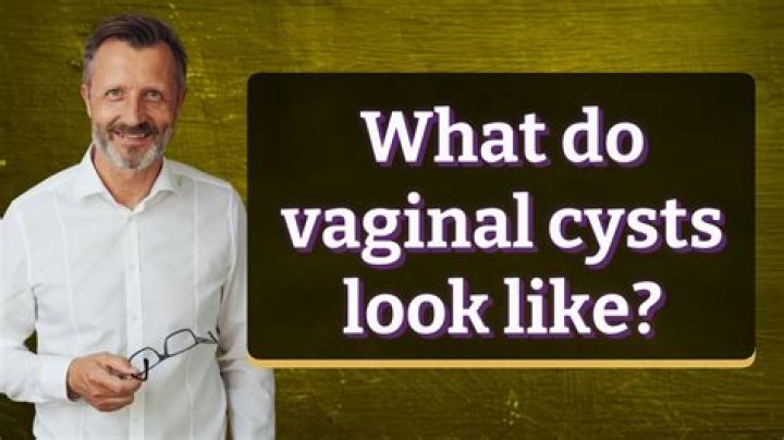 What does a cyst look like?