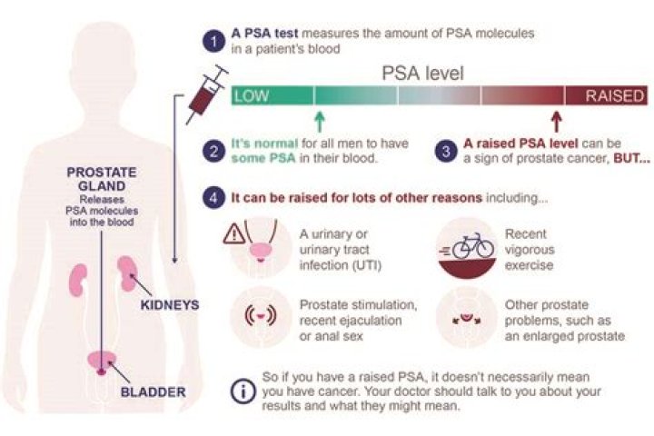 What does a PSA of 40 mean?