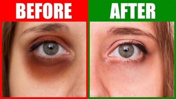 What does a star under the eye mean?