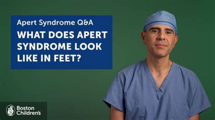 What does Apert syndrome look like?