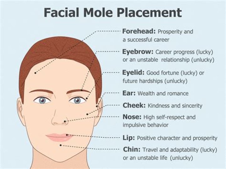 What does mole in eye mean?