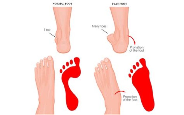 What does slow-footed mean?
