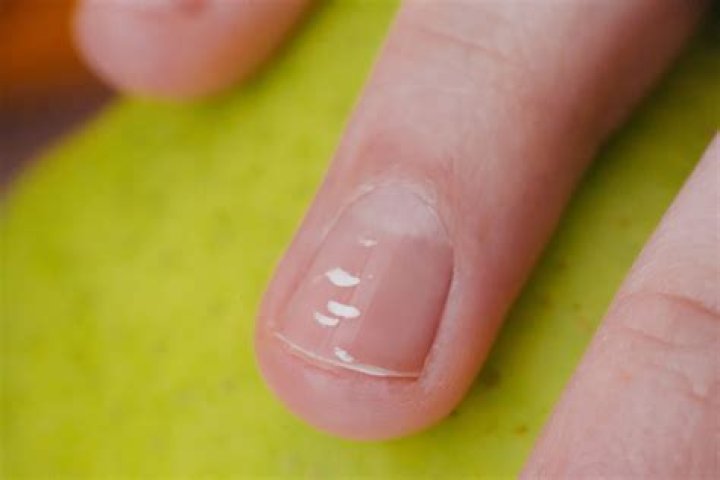 What does solar mean in nails?