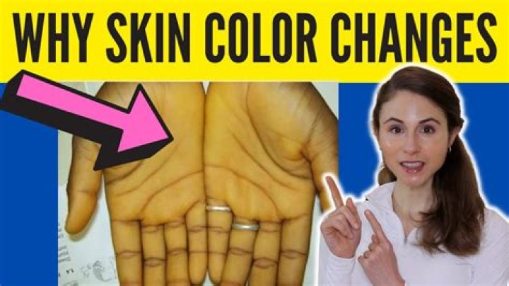 What food can change your skin color?