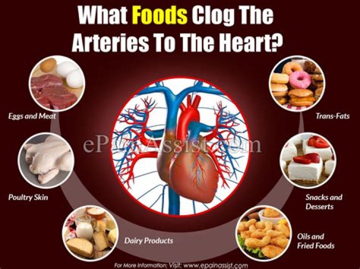 What food clogs arteries?