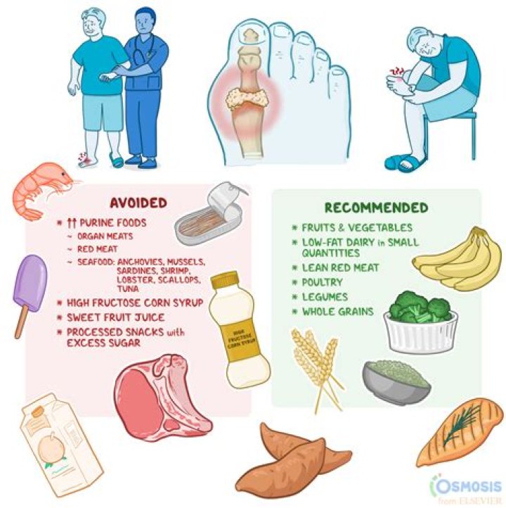 What food triggers cellulitis?