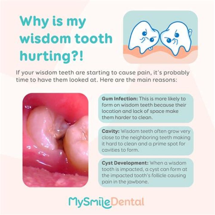 What happens if a wisdom tooth falls out by itself?