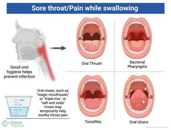 What happens if you have a sore throat for 3 days?