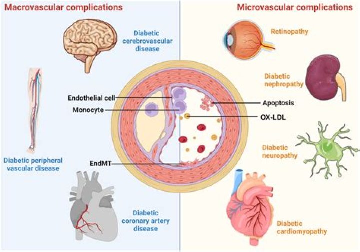 What is a macrovascular disease?