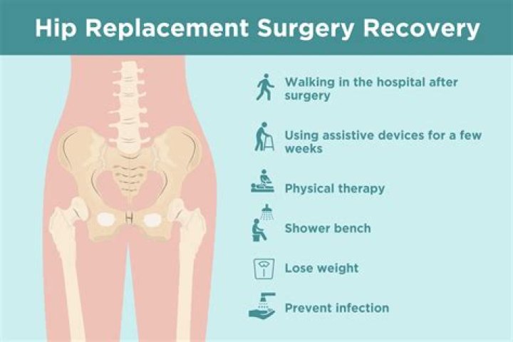 What is the best age to have a hip replacement?