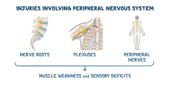What is the difference between nerve pain and muscle pain?