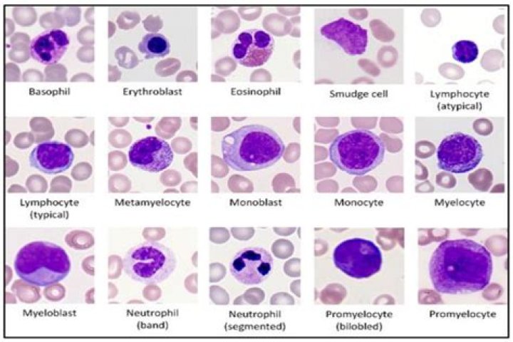 What is the lymphocyte count in leukemia?